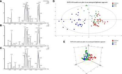 Integrated lipids biomarker of the prediabetes and type 2 diabetes mellitus Chinese patients
